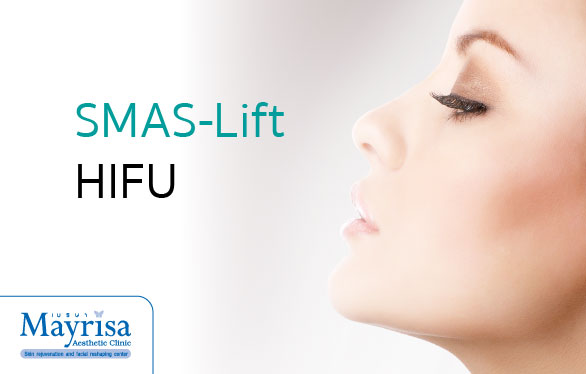 SMAS-Lift HIFU ที่ Mayrisa clinic